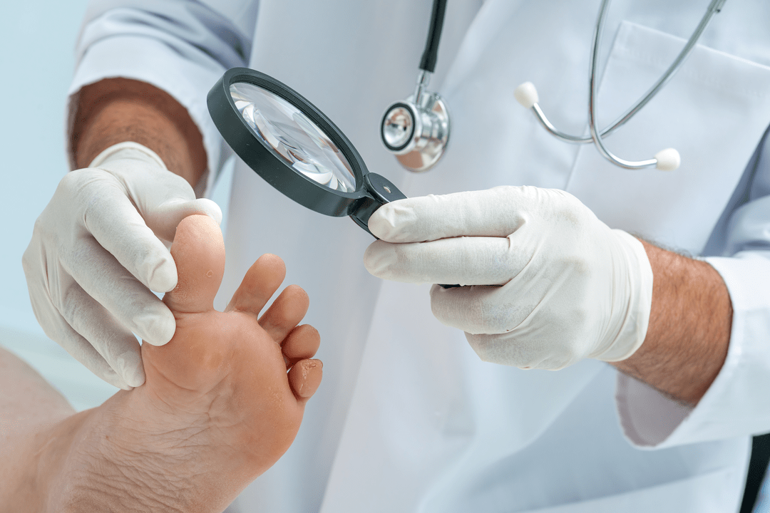 Diagnosis of toenail fungus