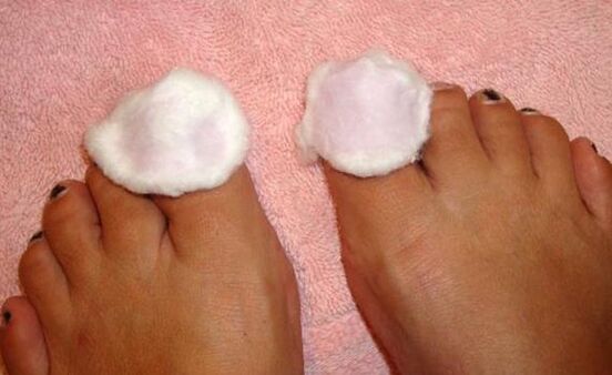 Compress for treating toenail fungus