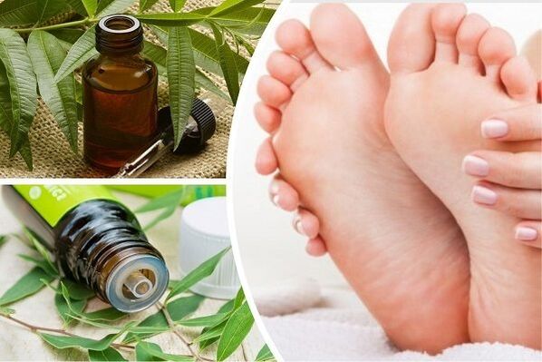Tea tree oil to eliminate onychomycosis