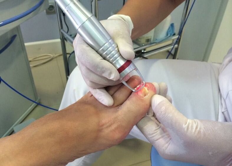 Treatment