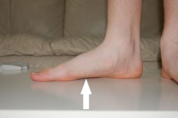 Flat feet are one of the causes of toenail fungus